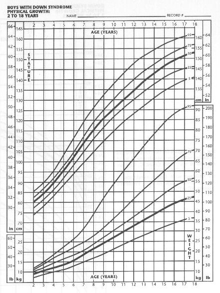 Trisomy 21 Growth Chart